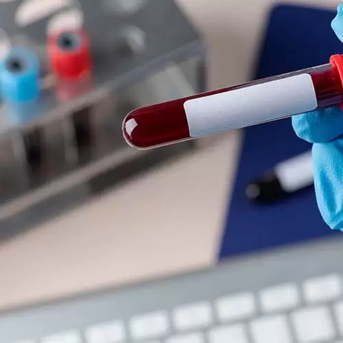 Tipuri de injectii la domiciliul pacientului
