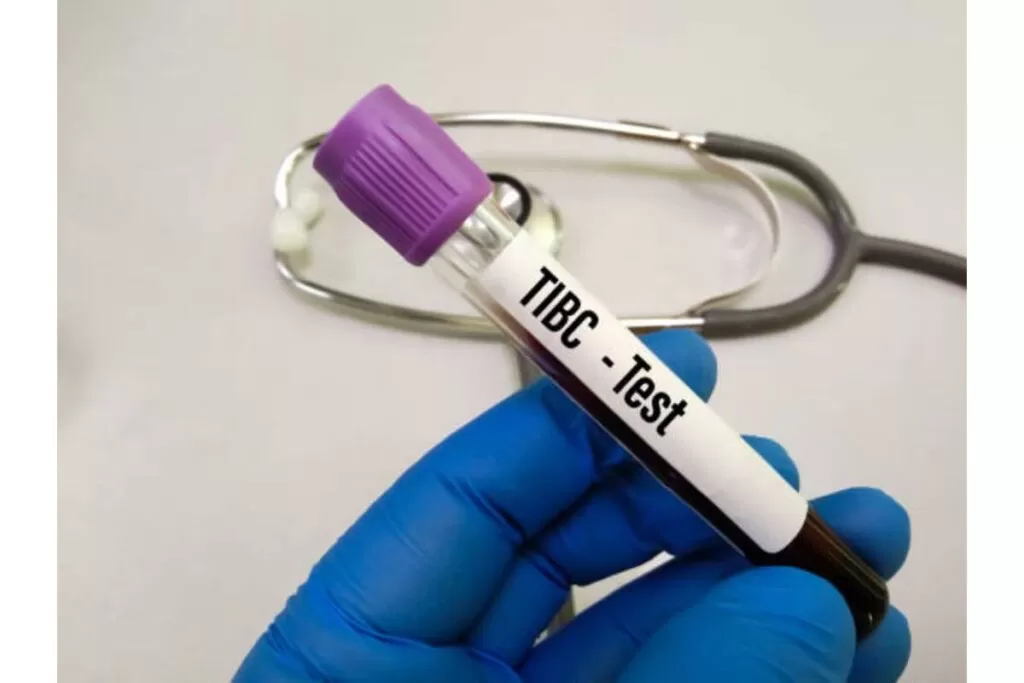 TIBC Test