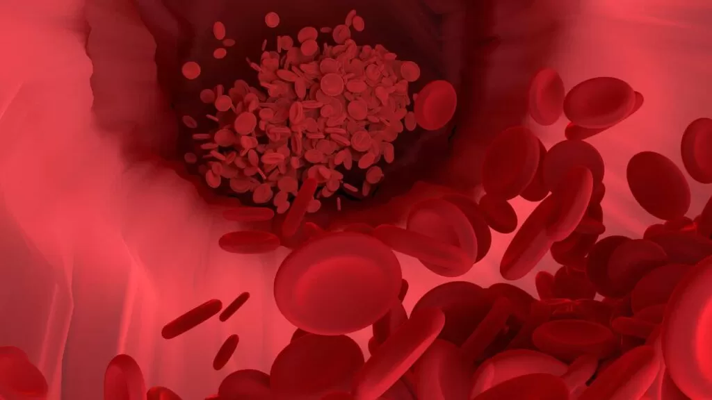 2. Despre hemofilie – ce tratament este recomandat pentru hemofilie - Reprezentare hemofilie